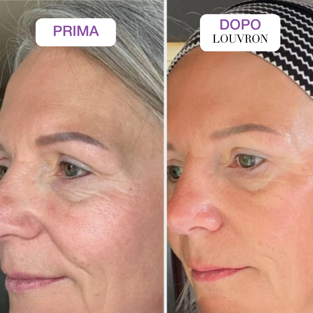 Maschera PDRN Collagene Caviale Box x4