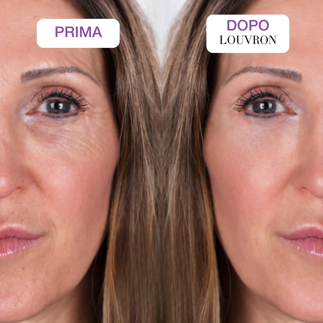 Maschera PDRN Collagene Caviale Box x4