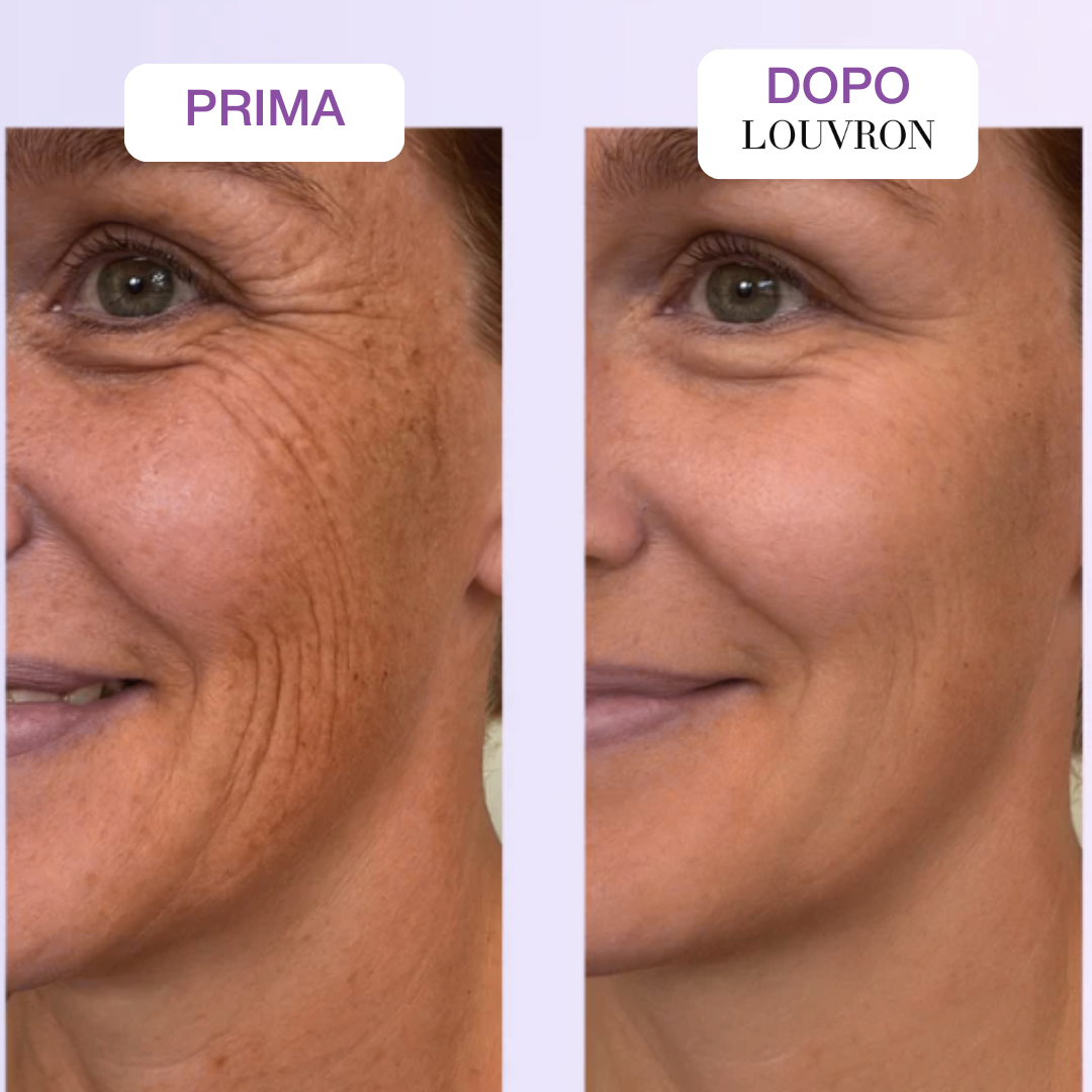 Nastro Bio-Silicone Collagene Anti-Età e Cicatrici