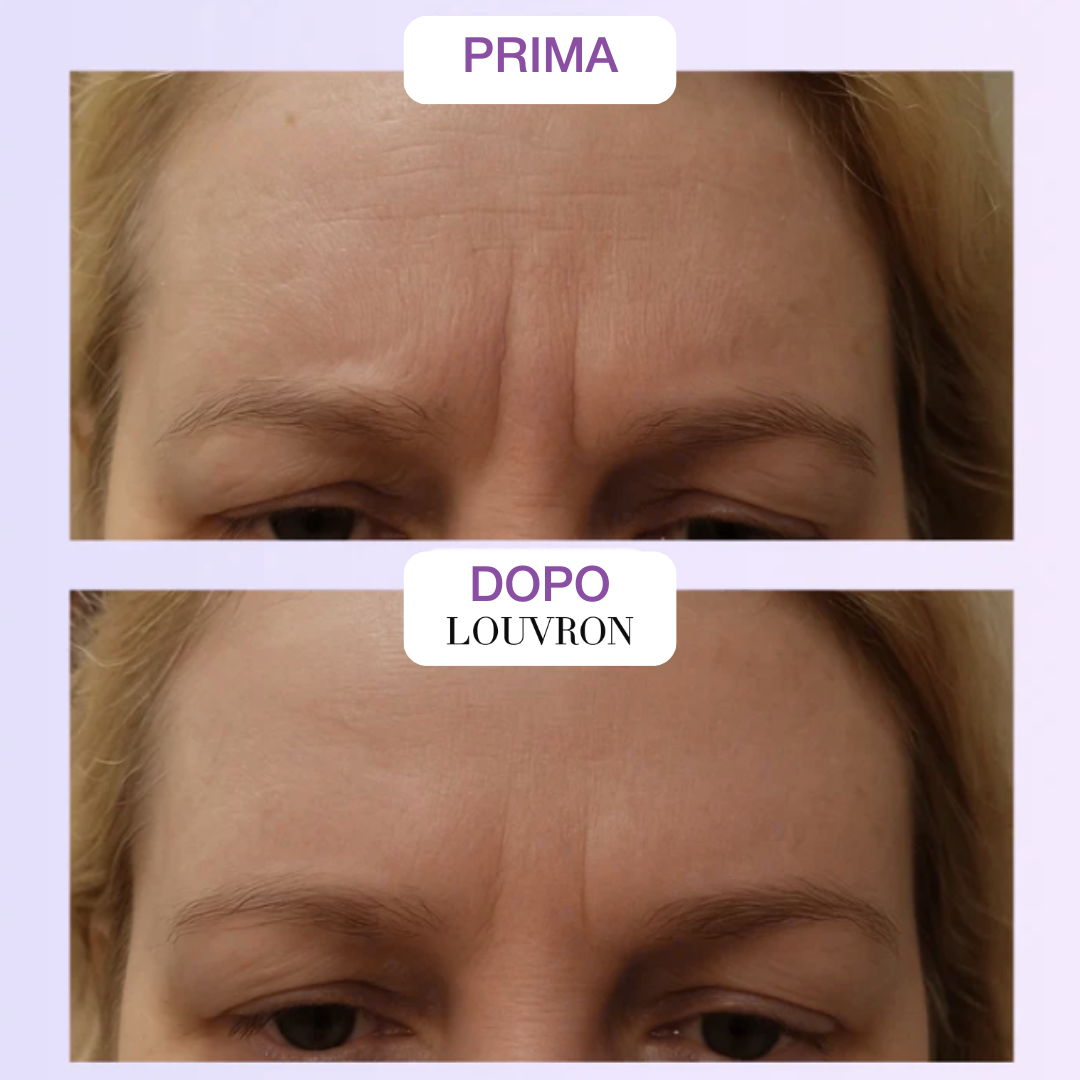 Nastro Bio-Silicone Collagene Anti-Età e Cicatrici