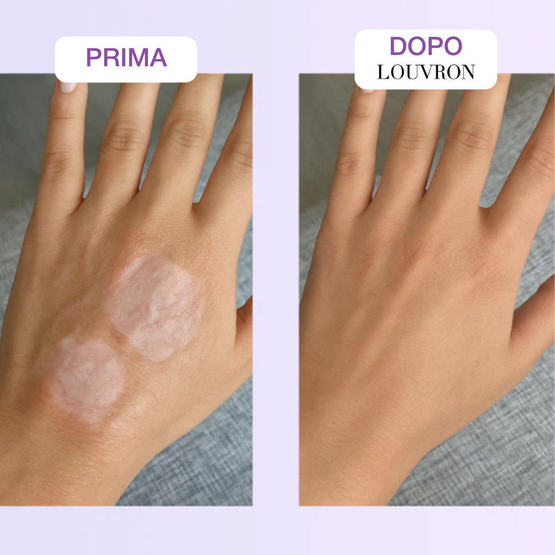 Nastro Bio-Silicone Collagene Anti-Età e Cicatrici