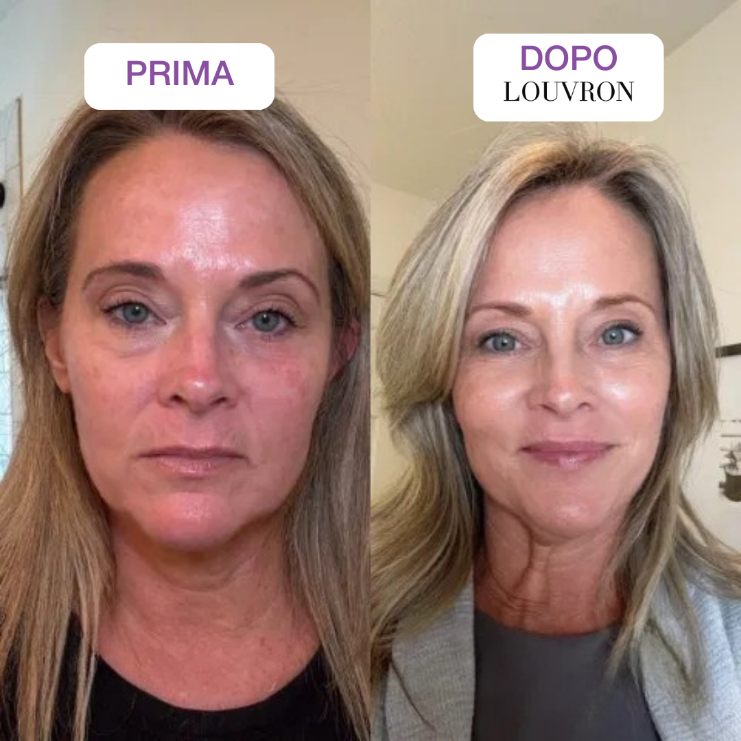 Retinal Shot Booster Rassodante