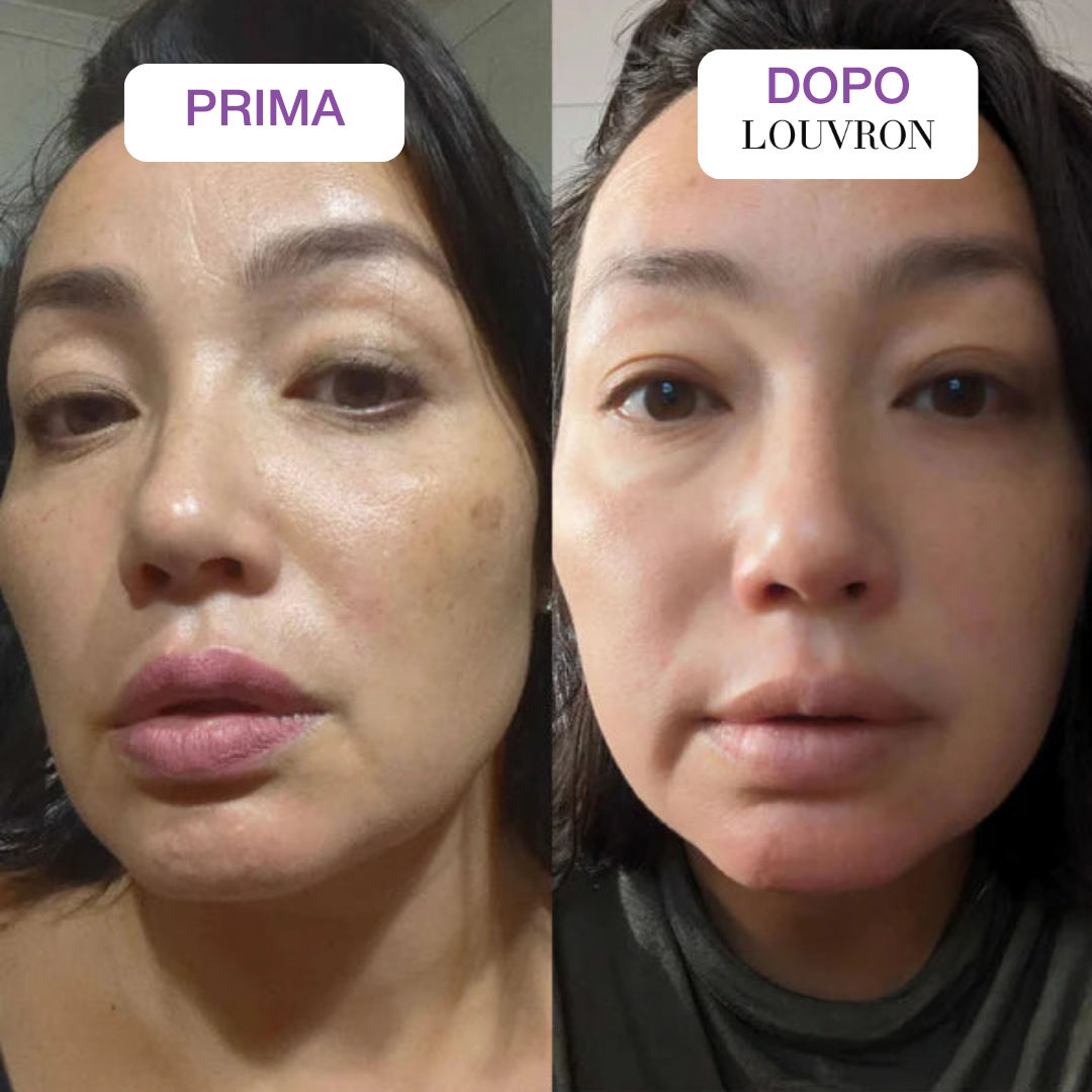 Retinal Booster Anti-Età
