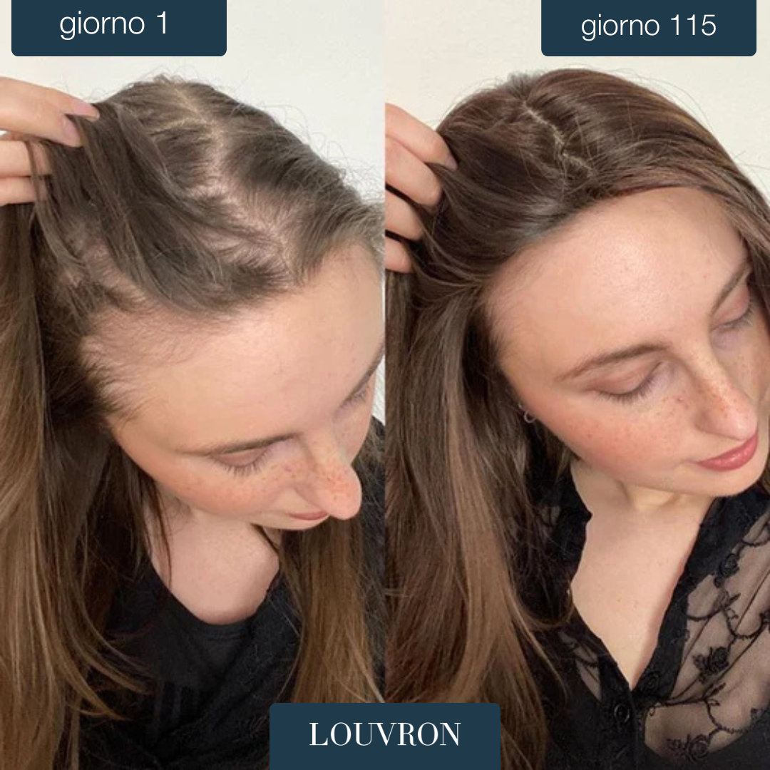 Louvron RootBoost™