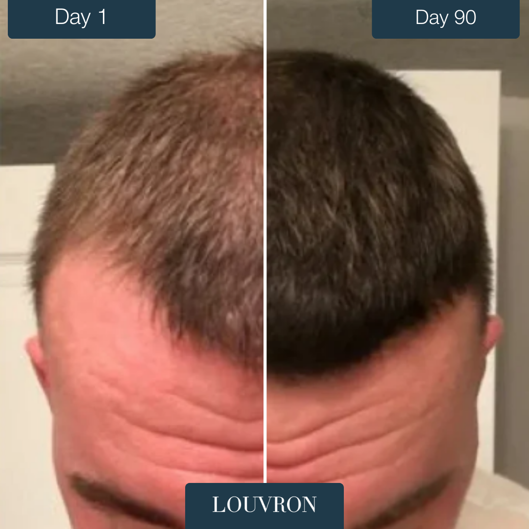 RootBoost™ Rigenerante Capelli