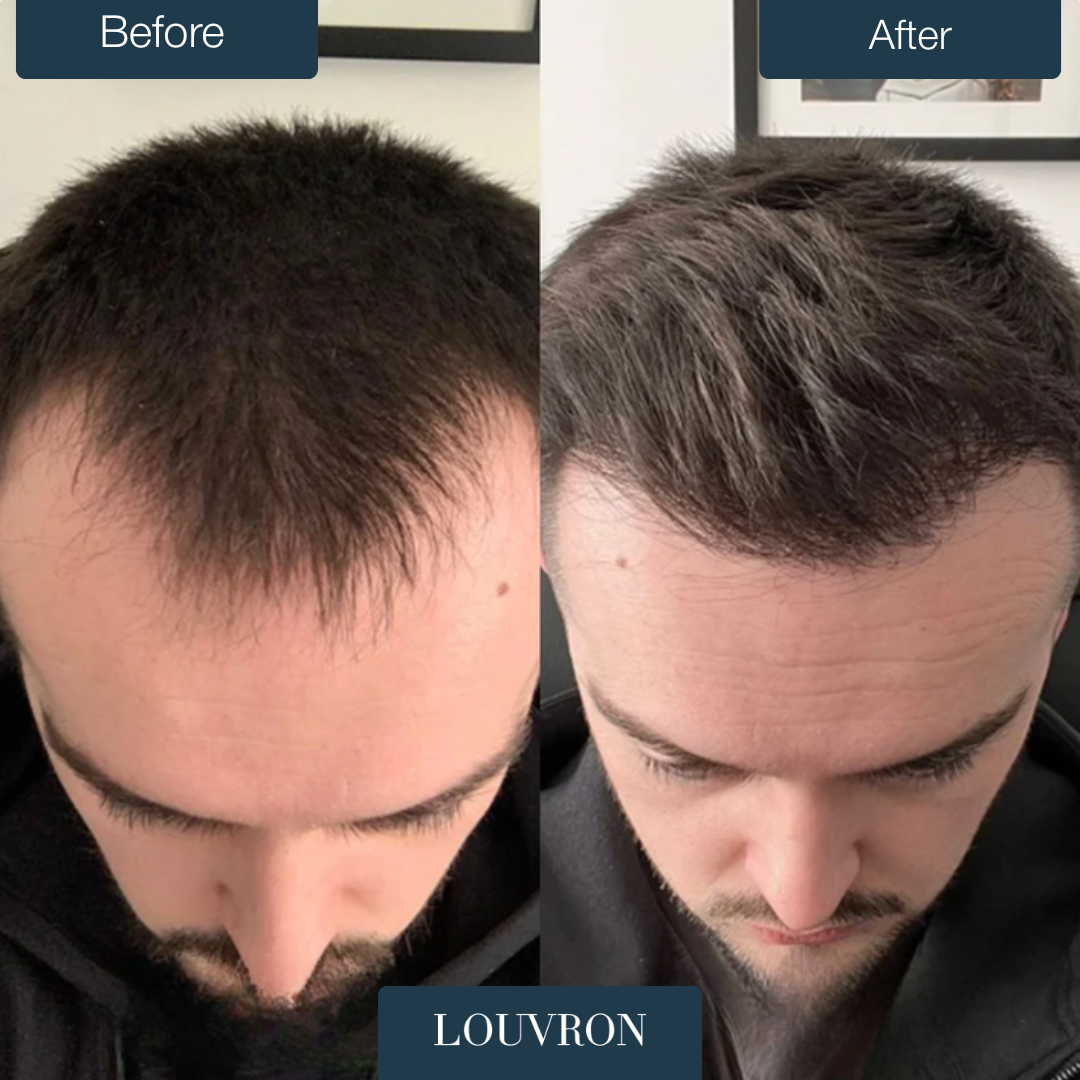 RootBoost™ Rigenerante Capelli